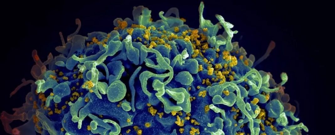 Medicamento contra o câncer elimina o HIV latente, revela novo estudo empolgante