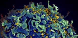 Medicamento contra o câncer elimina o HIV latente, revela novo estudo empolgante