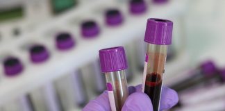 Novo exame de sangue pode detectar câncer e metástases precocemente