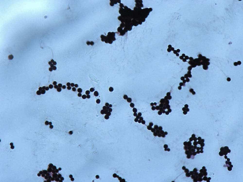 content 1580902633 1024px cryptococcus gram film - Fungos devoradores de radiação estão prosperando nas paredes dos reatores de Chernobyl