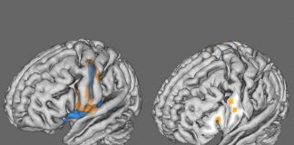 Mesmo COVID ‘leve’ está ligado a mudanças cerebrais significativas, revela grande estudo