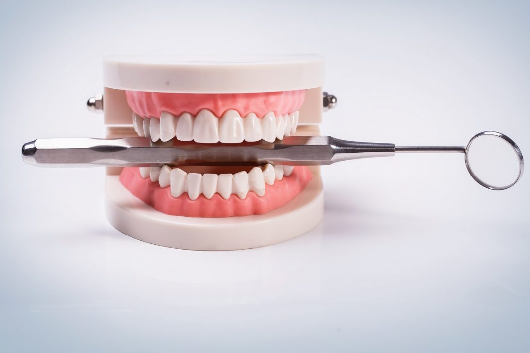 Novas evidências de que os dentes podem preencher suas próprias cavidades