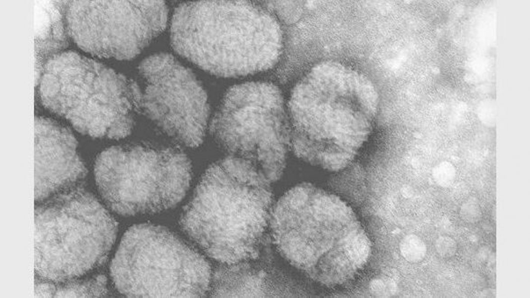 Ministério da Saúde investiga dois casos suspeitos de varíola dos macacos