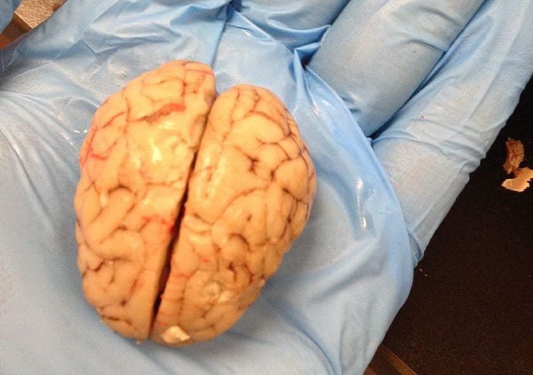 Cientistas restauram algumas funções no cérebro de um porco horas após a morte