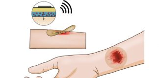 Bandagem inteligente monitora ferimentos em tempo real
