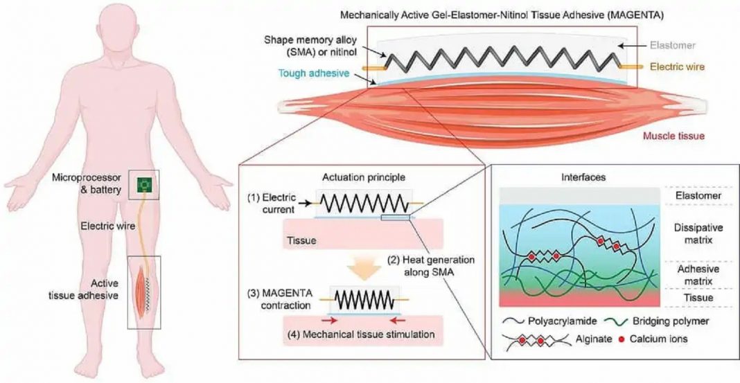 Cientistas desenvolvem adesivo que previne a atrofia muscular e permite a recuperação