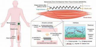 Cientistas desenvolvem adesivo que previne a atrofia muscular e permite a recuperação