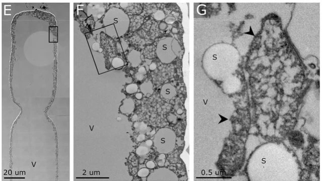 revistasaberesaude.com - Megabactérias que podem ser vistas sem um microscópio abalam o campo da microbiologia