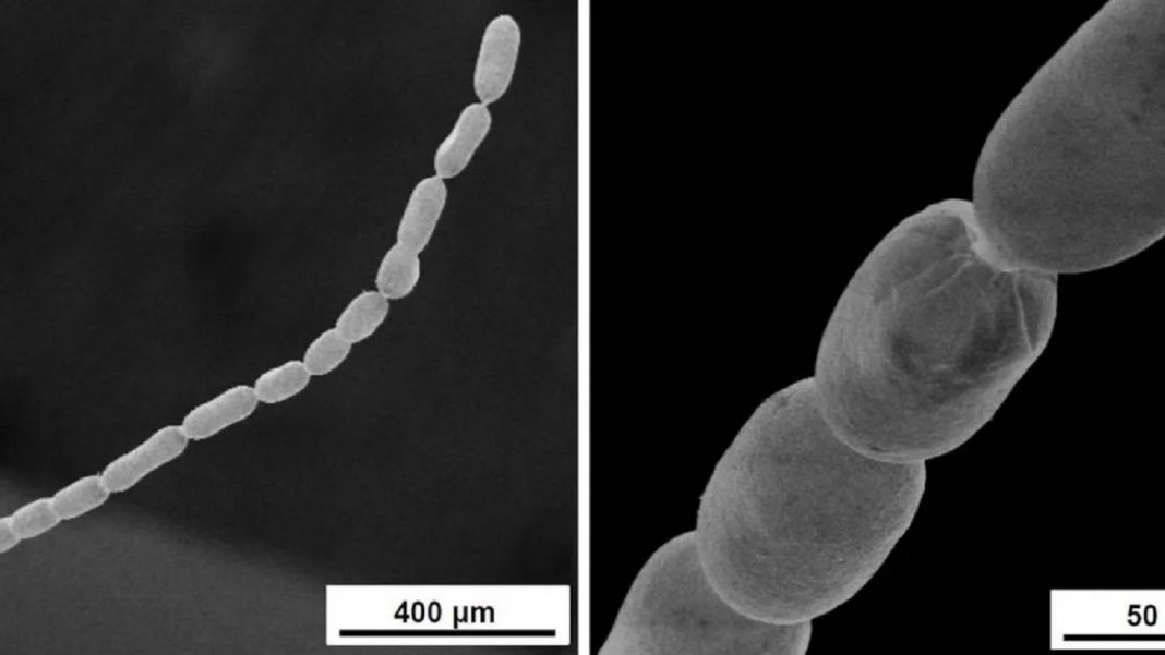 Megabactérias que podem ser vistas sem um microscópio abalam o campo da microbiologia