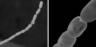 Megabactérias que podem ser vistas sem um microscópio abalam o campo da microbiologia