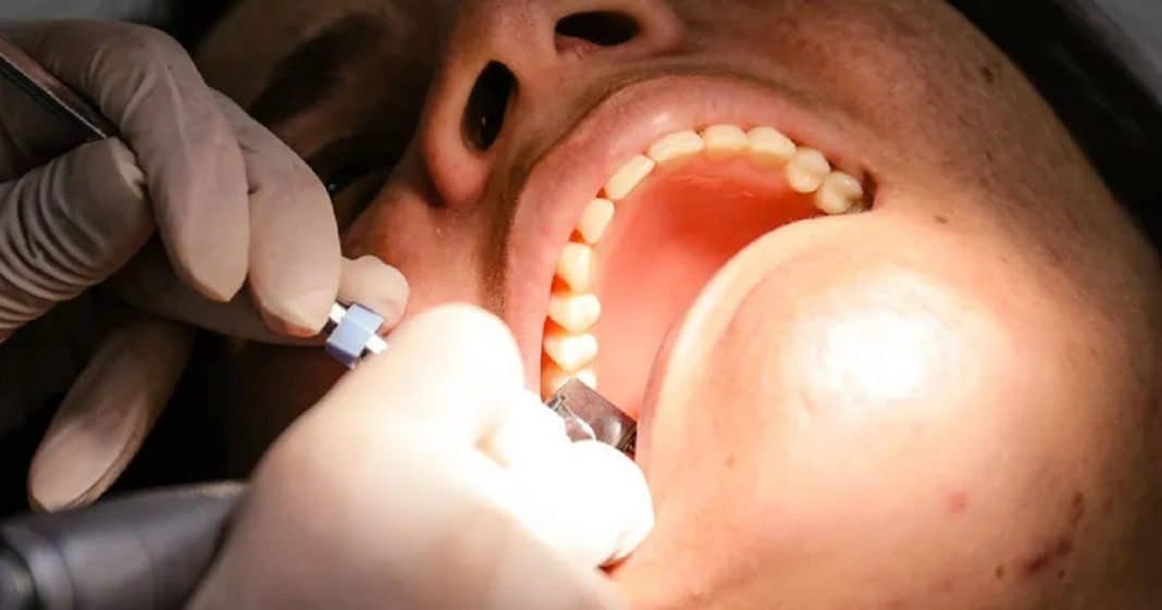 USP desenvolve hidrogel que ajuda a tratar erosão e sensibilidade dos dentes