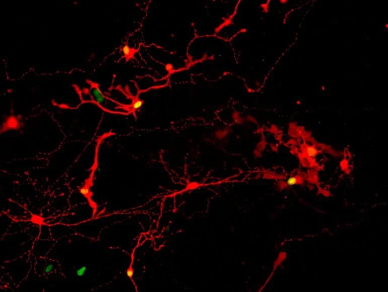 revistasaberesaude.com - Retinas desenvolvidas em laboratório para restaurar a visão estão um passo mais perto dos testes em humanos