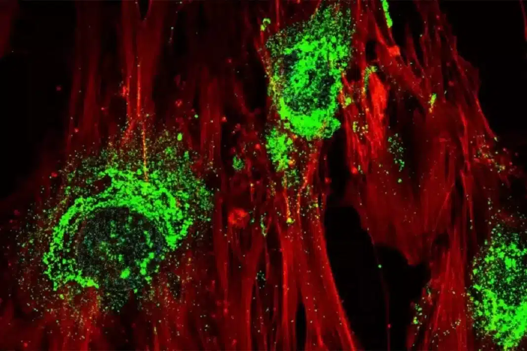 Cientistas usam ondas sonoras para transformar células-tronco humanas em células ósseas
