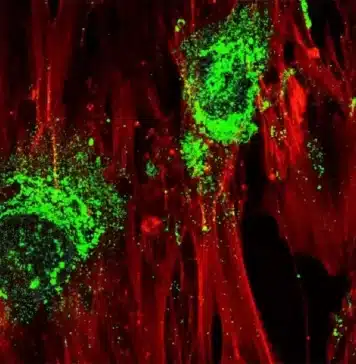 Imagem ampliada mostrando células-tronco adultas em processo de transformação em células ósseas