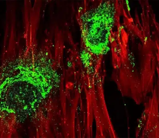 Imagem ampliada mostrando células-tronco adultas em processo de transformação em células ósseas