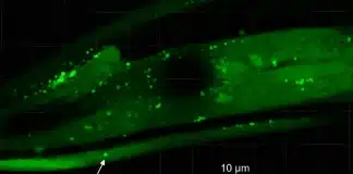 Bactéria aquática comum pode ser a causadora do mal de Parkinson