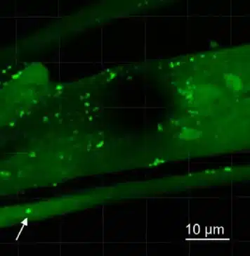 Pontos brilhantes indicam a presença de aglomerados de alfa-sinucleína dentro das cabeças de vermes alimentados com a bactéria Desulfovibrio.