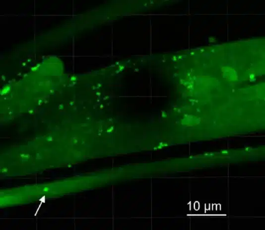 Pontos brilhantes indicam a presença de aglomerados de alfa-sinucleína dentro das cabeças de vermes alimentados com a bactéria Desulfovibrio.